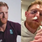 Ben Stokes Injury Update: England Captain